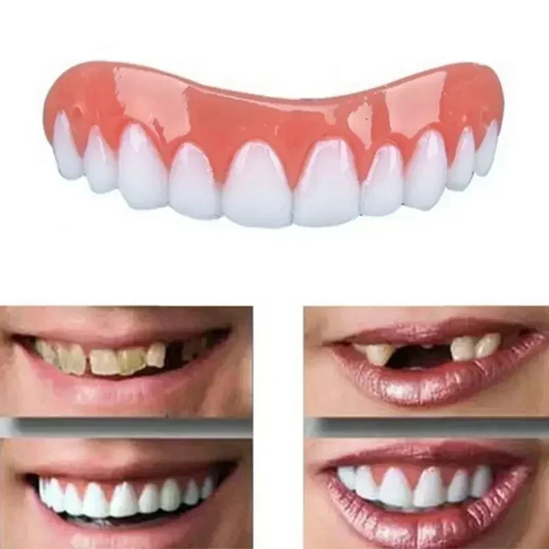 Teeth Whitening Veneers - Gigi Palsu Silikon Baru, Veneer Atas
