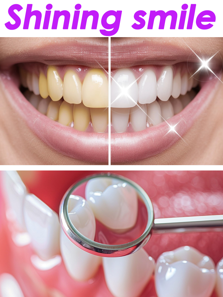 Teeth Whitening Xylitol - GlorySmile Produk Pasta Gigi Buah Pemutih