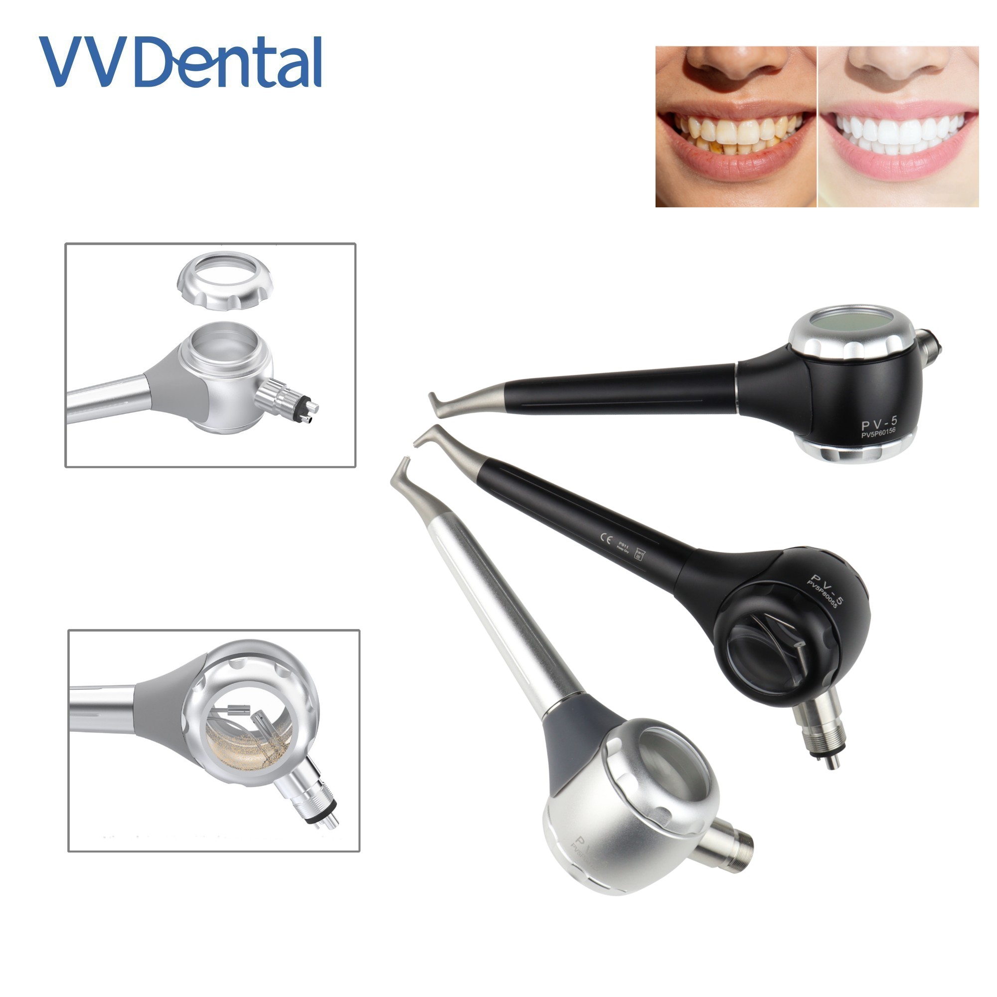Teeth Whitening Free - VV Dental 2/4 Lubang Pistol Pemutih