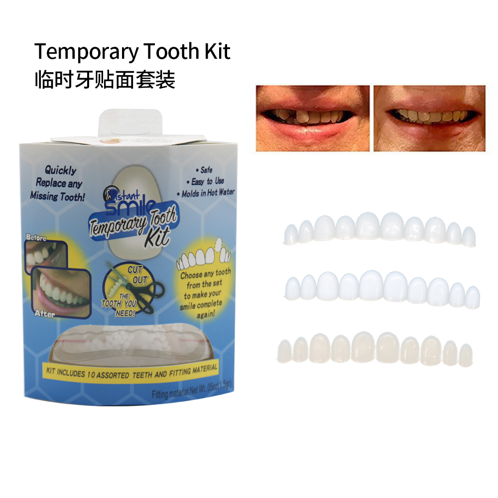Teeth Whitening Veneers - Gigi Palsu Veneer Gigi Tiruan Atas