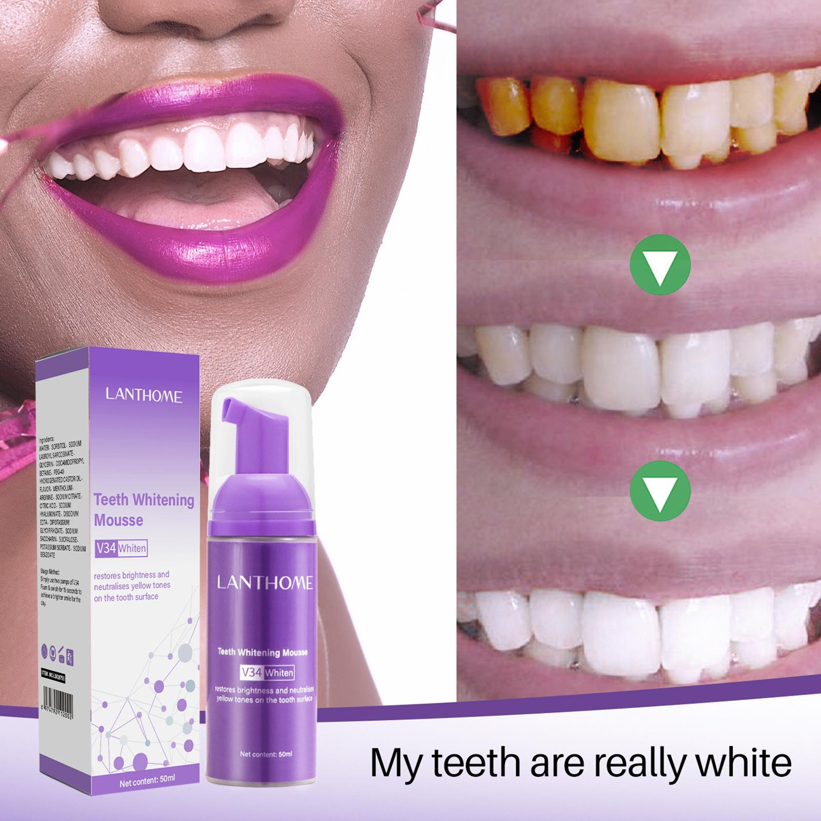V34 pasta gigi Mousse efektif  - Teeth Whitening Mousse ulasan dan harga
