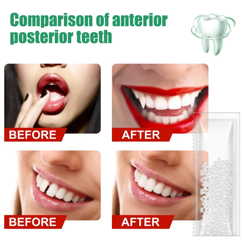 10g50g/30Ml Lem Perbaikan Gigi - Teeth Whitening At Home ulasan dan harga