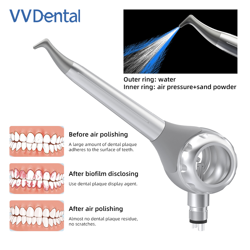 VV Dental 2/4 Lubang Pistol Pe - Teeth Whitening Free ulasan dan harga