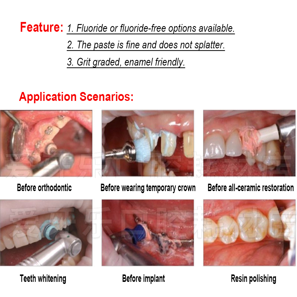 Pasta Pemoles Gigi Ivoclar Viv - Teeth Whitening Xylitol ulasan dan harga