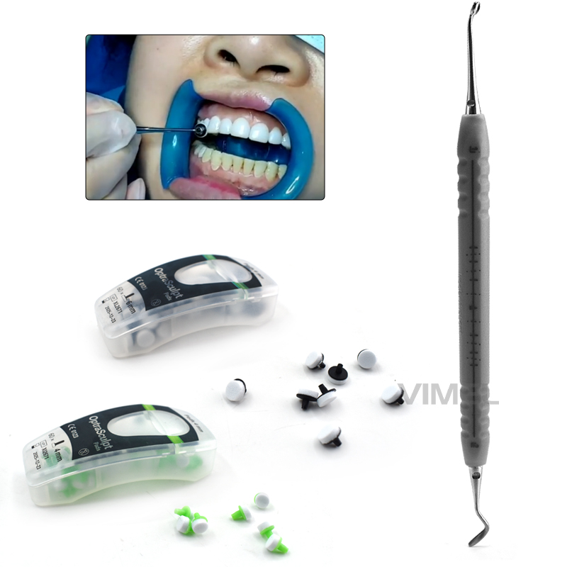 Ivoclar Vivadent Kit Bantalan  - Teeth Whitening Veneers ulasan dan harga