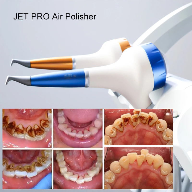 VV Dental Air Polishing Prophy - Teeth Whitening Free ulasan dan harga