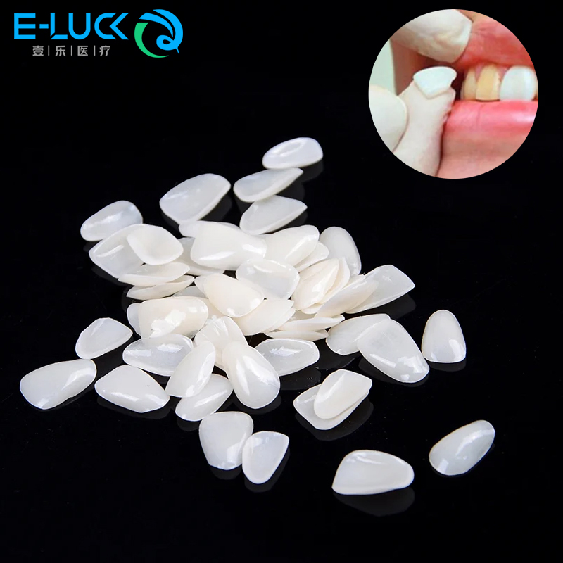 50 buah pelapis gigi sementara - Teeth Whitening Veneers ulasan dan harga