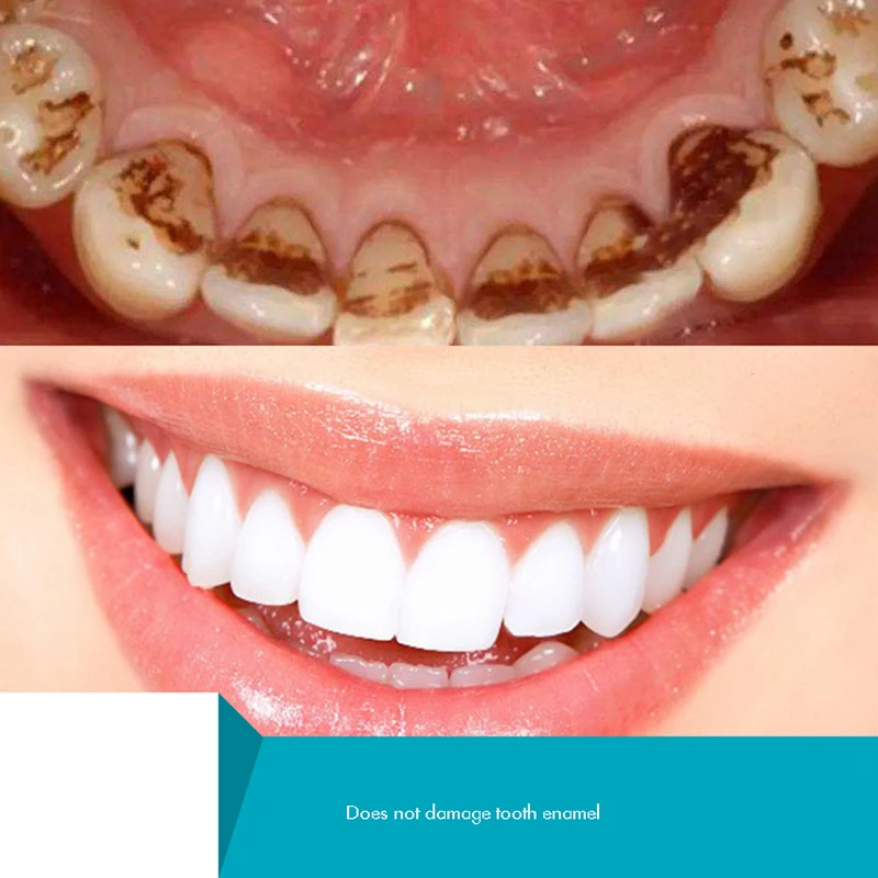 Bubuk Gigi Herbal, Bubuk Pemut - Teeth Whitening Xylitol ulasan dan harga