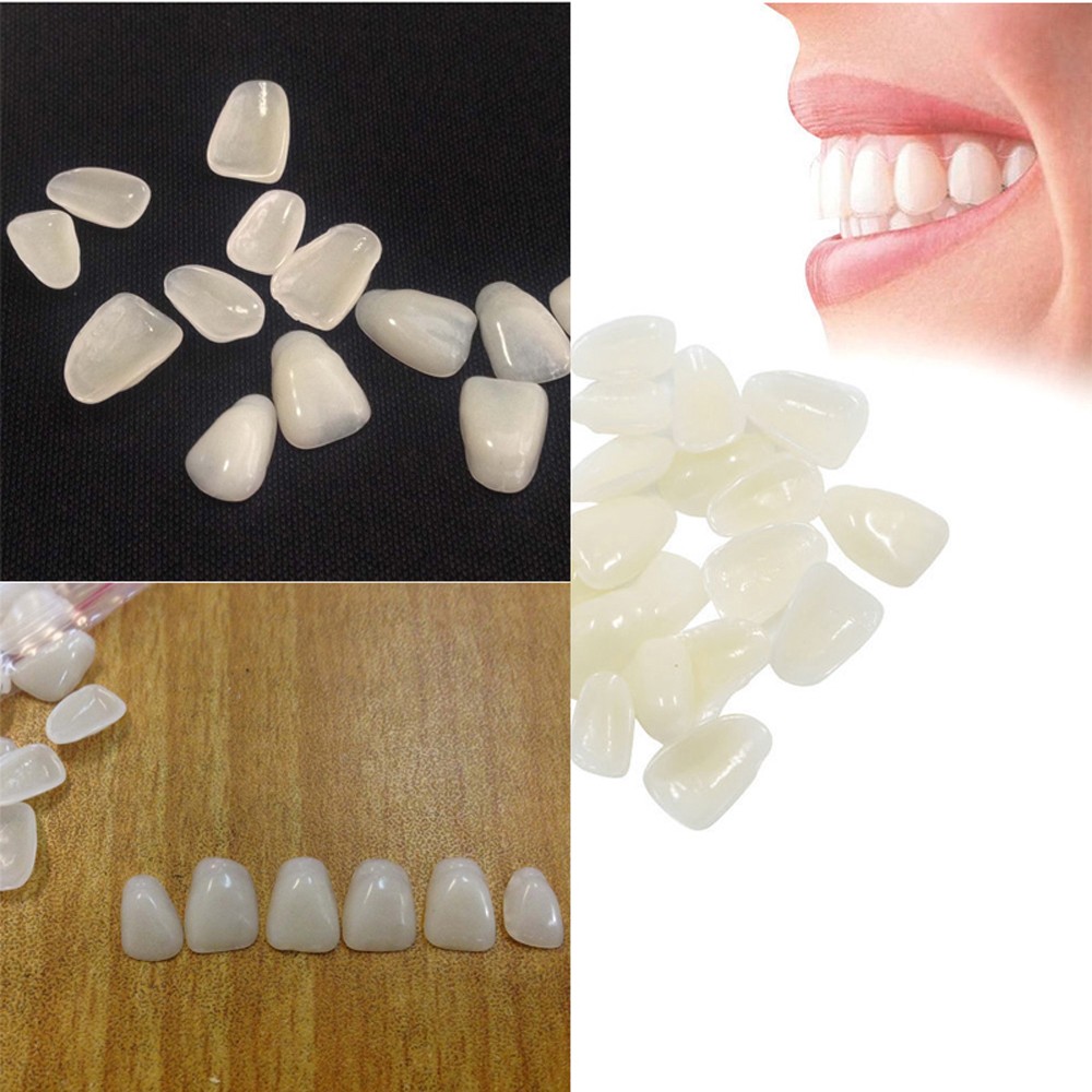 70PCS/Paket Veneer Kecantikan  - Teeth Whitening Veneers ulasan dan harga