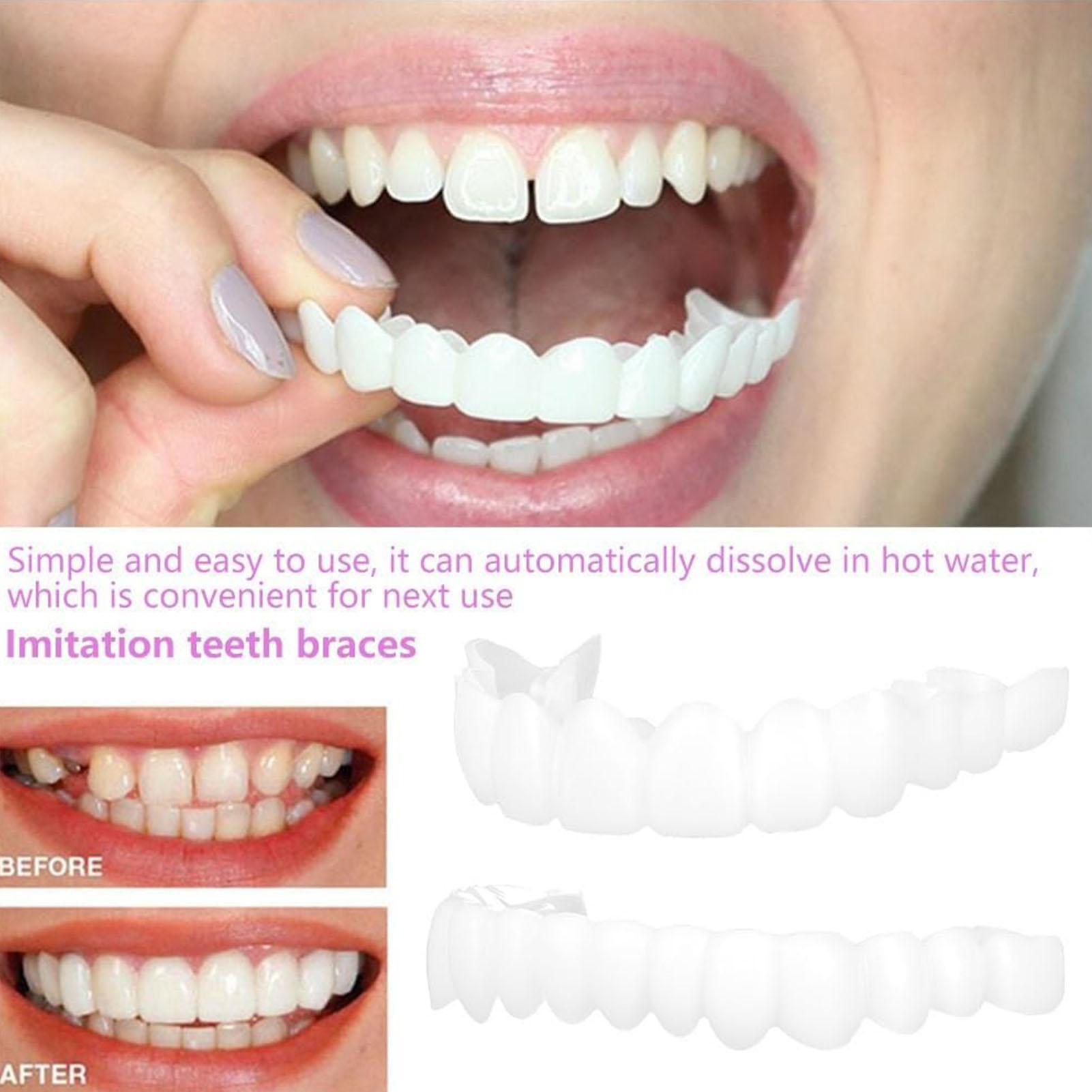 2pcs Veneer Gigi Temporer Pria - Teeth Whitening Veneers ulasan dan harga