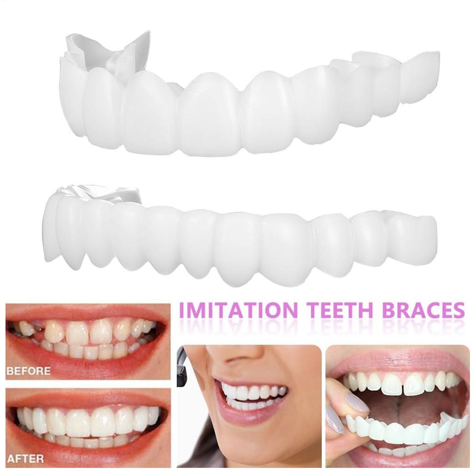 2pcs Veneer Gigi Temporer Pria - Teeth Whitening Veneers ulasan dan harga