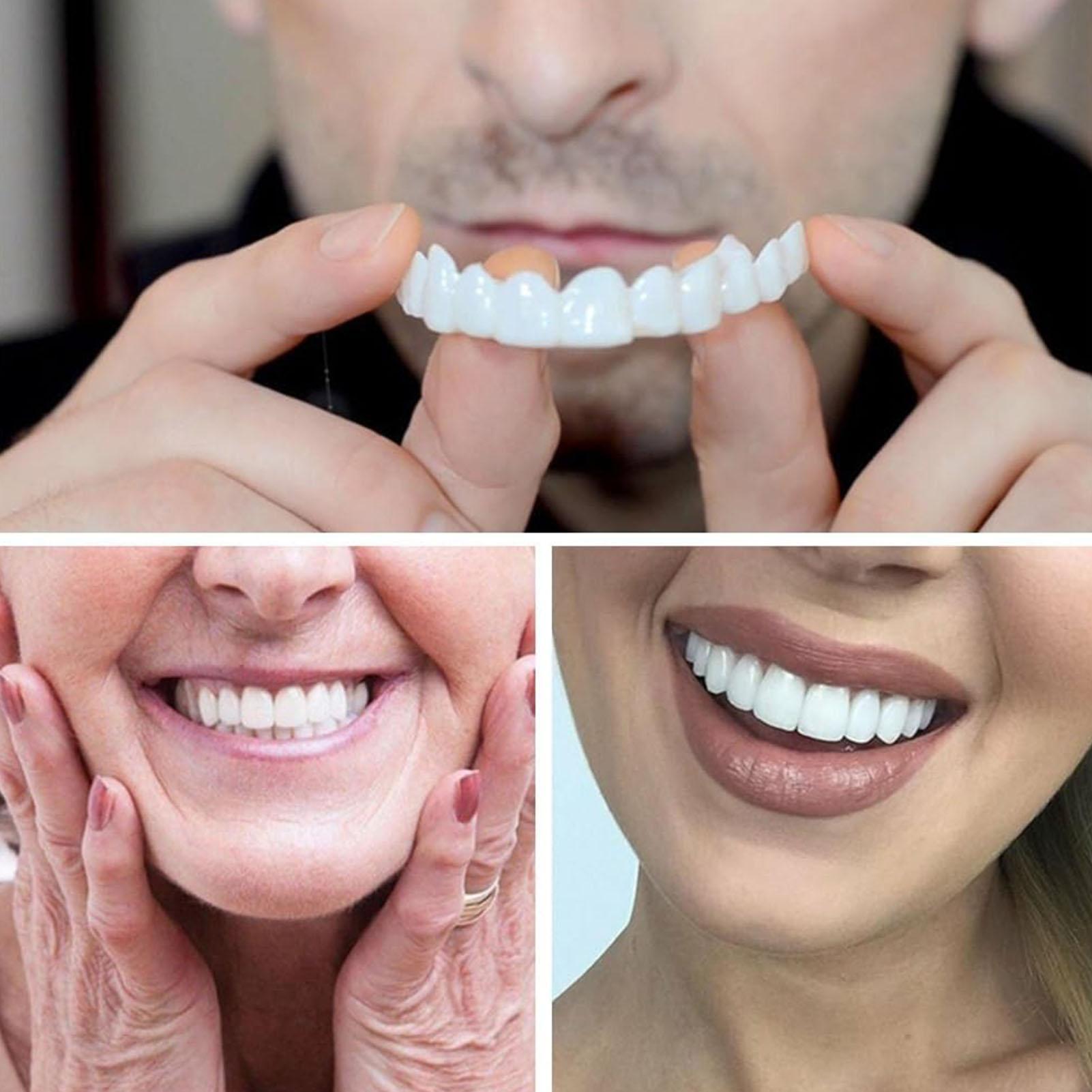 2pcs Veneer Gigi Temporer Pria - Teeth Whitening Veneers ulasan dan harga