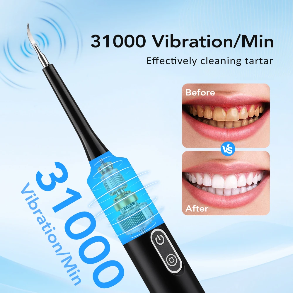 Alat Pembersih Karang Gigi Ele - Teeth Whitening Uk ulasan dan harga